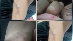 Oknum Guru Diduga Lakukan Pemukulan di Tanggamus